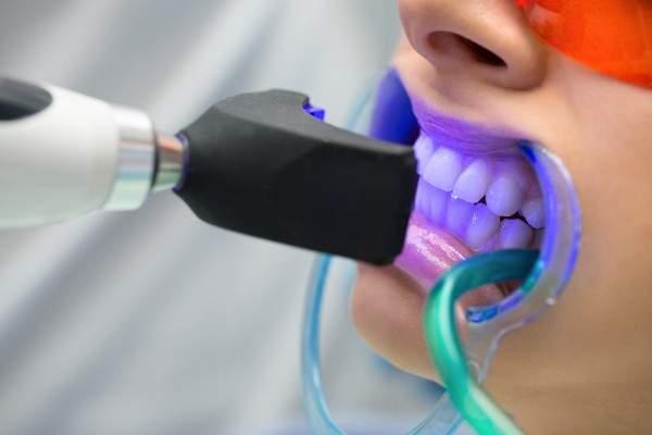 teeth whitening Stockport,